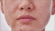 Award-Winning Natural Facial Oil For Deep Hydration & Healthy Glow